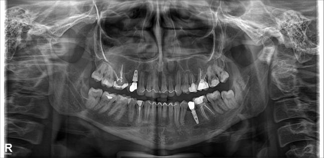 Radiografia Panor�mica